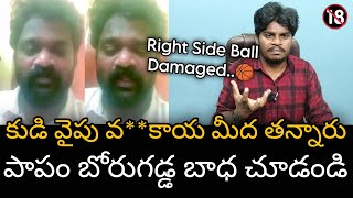 బోరుగడ్డ కుడివైపు బాల్ పైన తన్నారు || Borugadda Anilkumar Selfie Video about His Right Side Ball