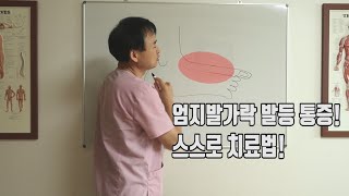 엄지발가락 발등쪽에서 나타나는 통증! 혼자서 완벽하게 치료하는법 [발등통증/ 엄지발가락 통증]