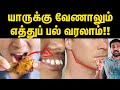 எத்து பல் வருவது எதனால்? சரி பண்ண முடியுமா? | Tooth protection tips in Tamil | Uyirmei