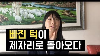 [박영민목사  치유사역 간증영상] 안수 기도를 통한 빠진 턱이 제자리로 돌아온 기적 / 노혜민(초등학교 5학년)