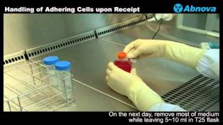 Handling of Adhering Cells upon Receipt