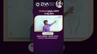 IUI తరువాత ప్రెగ్నెన్సీ రాకపోతే ఈ టెస్ట్ చేస్తారు | HSG Test | Dr C Suvarchala | Ziva Fertility