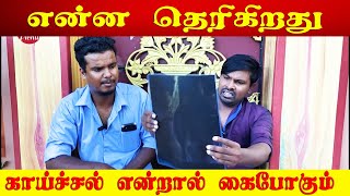 யாழில் நடந்த சம்பவம் | தாதியின் அசமந்த போக்கினால் கையை இழந்த சிறுமி | Akkuddiyum pichumaniyum