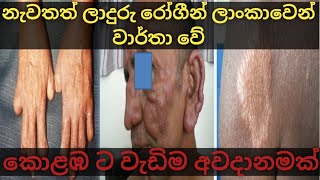 Leprosy | ලාදුරු රෝගය සීග්‍රයෙන් ඉහළට | කොළඹ ට වැඩි අවදානමක් | Sinhala