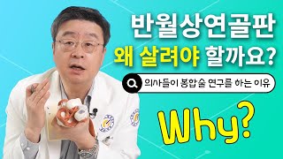 반월상연골파열 후 수술의 기술, 무릎연골을 살리는 방향으로 줄기세포까지 연구되는 이유