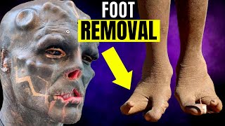 Black Alien Project Disturbing Foot Modification (This Will Ruin His Life!)