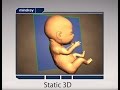 Step by Step to Get Perfect 3D/4D Baby Image Step by Step to Get Perfect 3D/4D Baby Image