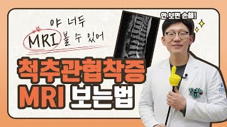 힘내쇼 15화 '황진호의 척추비책' 야 너두 MRI 볼 수 있어! 척추관협착증 MRI 보는법. 꿀팁 대방출🍯!!