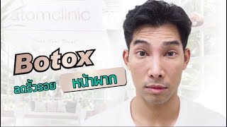 ATOMCLINIC : BOTOX ริ้วรอย จบปัญหาหน้าย่น กลับมาหน้าเด็กอีกครั้ง