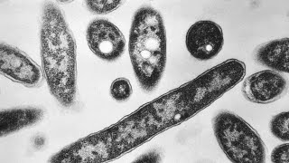 Iowa HHS now says 21 cases of Legionnaires' disease, 1 death in Marshall County 'cluster'