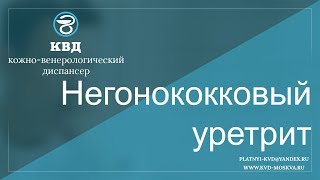 370  Негонококковый уретрит