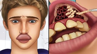 ASMR Remove botfly maggots found inside mountaineer's mouth | Dental care animation TWI ASMR