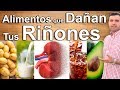 ALIMENTOS QUE DAÑAN TUS RIÑONES - 7 Comidas Que Debes Evitar Si Tienes Insuficiencia Renal