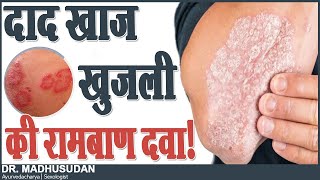 दाद खाज खुजली की रामबाण दवा || Skin Disease || Dr. Mdhusudan