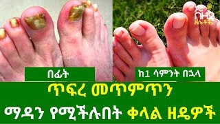 Ethiopia:- ጥፍረ መጥምጥን  ማዳን የሚችሉበት ቀላል ዘዴዎች | Nuro Bezede Girls