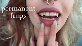 all about my permanent fangs | FAQ / cost/ aftercare & how you can get them!