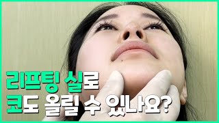 리프팅 실로 코 리프팅도 가능한가요?