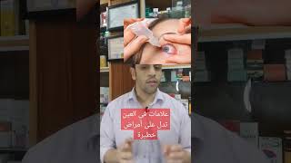 علامات فى العين تدل على أمراض خطيرة لا تهملها🤨 #مقاومة_الانسولين