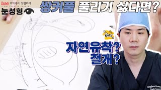 [Dr.허니팁] 자연유착?부분절개?절개?🙊쌍커풀 풀리기 싫다면?