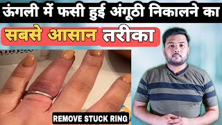 ऊंगली में फसी रिंग को कैसे निकाले | How to remove ring from swollen finger | remover ring in finger