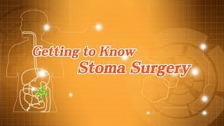 Getting to Know Stoma Surgery