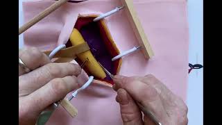 Inguinal hernia