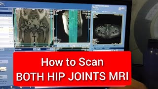 Hip Joints MRI Scan Protocol, Positioning \u0026 Planning  | Live Demo on GE 1.5 Tesla