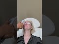 IPL Treatment for Dry Eye with Ocular Rosacea full procedure