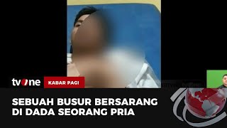 Karena Motif Dendam, Seorang Pria Nekat Aniaya Pemuda dengan Busur | Kabar Pagi tvOne