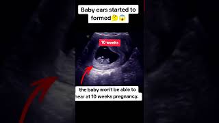 Baby ears started to formed at 10 weeks pregnancy|#ultrasound #viralshorts