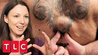 Doctor Doesn't Want To Remove Man's Lipoma As It Makes His Tattoo Better! | The Bad Skin Clinic