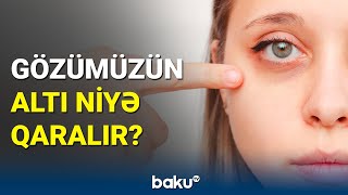 Göz ətrafındakı qaralmalar hansı xəstəliklərin əlamətidir?