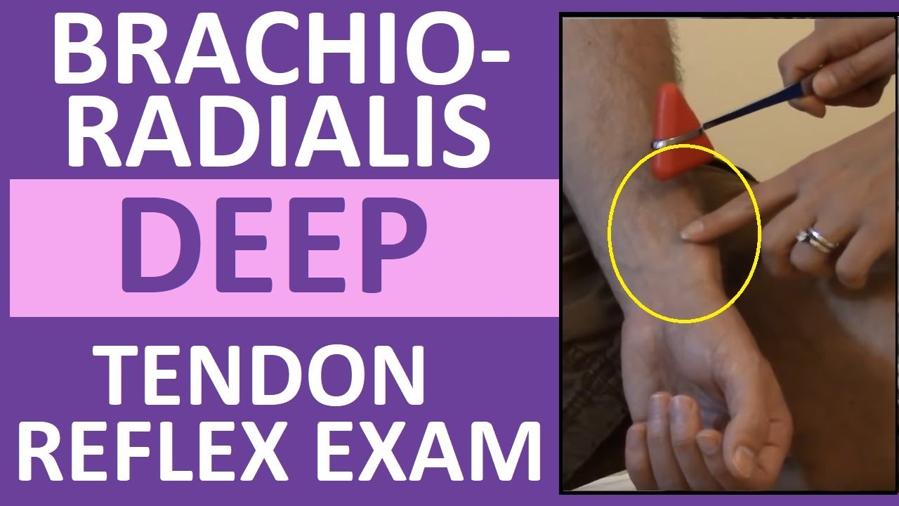 Brachioradialis Deep Tendon Reflex Examination | Nursing Head To Toe ...