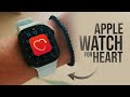 How Do I Use Apple Watch for My Heart? (explained)