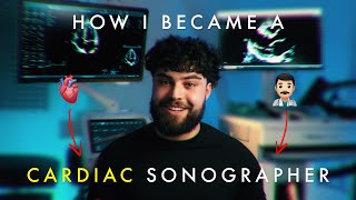 My Journey as a Cardiac Sonographer and THE SKILLS YOU NEED!