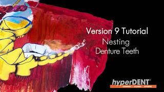 hyperDENT V9 Tutorial:  Nesting Denture Teeth