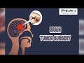 Successful Brain Tumor Surgery