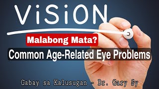 Malabong Mata? Common Age-Related Eye Problems - Dr. Gary Sy