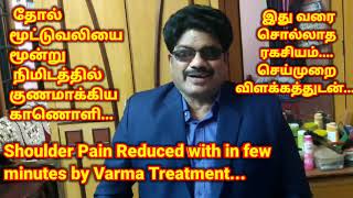 Shoulder Pain Reduced within Few Minutes | #shoulder_pain #frozen_shoulder #acupuncture_in_tamil