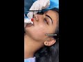 jyothakka permanentlipstick at hkpermanentmakeup clinic hyd 9052339052 vij 9000002422