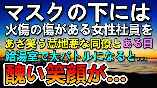 【感動する話】職場の派遣の女性の顔に大きな傷が→同僚から嫌味を言われていた…ある日彼女から聞いた義母との昔話に驚いた俺。その後同僚とバトルになった彼女は…