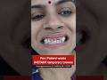 INSTANT temporary tooth caps in 15 minutes! Dr. Srishti Bhatia #smiletransformation