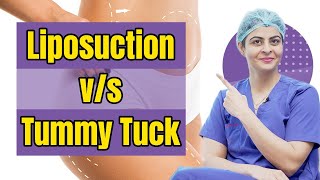 Do you need Tummy Tuck or Liposuction?| Which is Right for you?| Dr Diksha Dixit