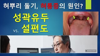 성곽유두와 설편도의 차이, 혀뿌리 돌기가 혀통증의 원인? 성곽유두의 비대는 반복적인 자극, 만성적인 염증이 원인