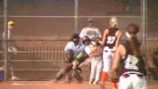 14 Year Old Pitcher Gets Hit In Face With Softball.