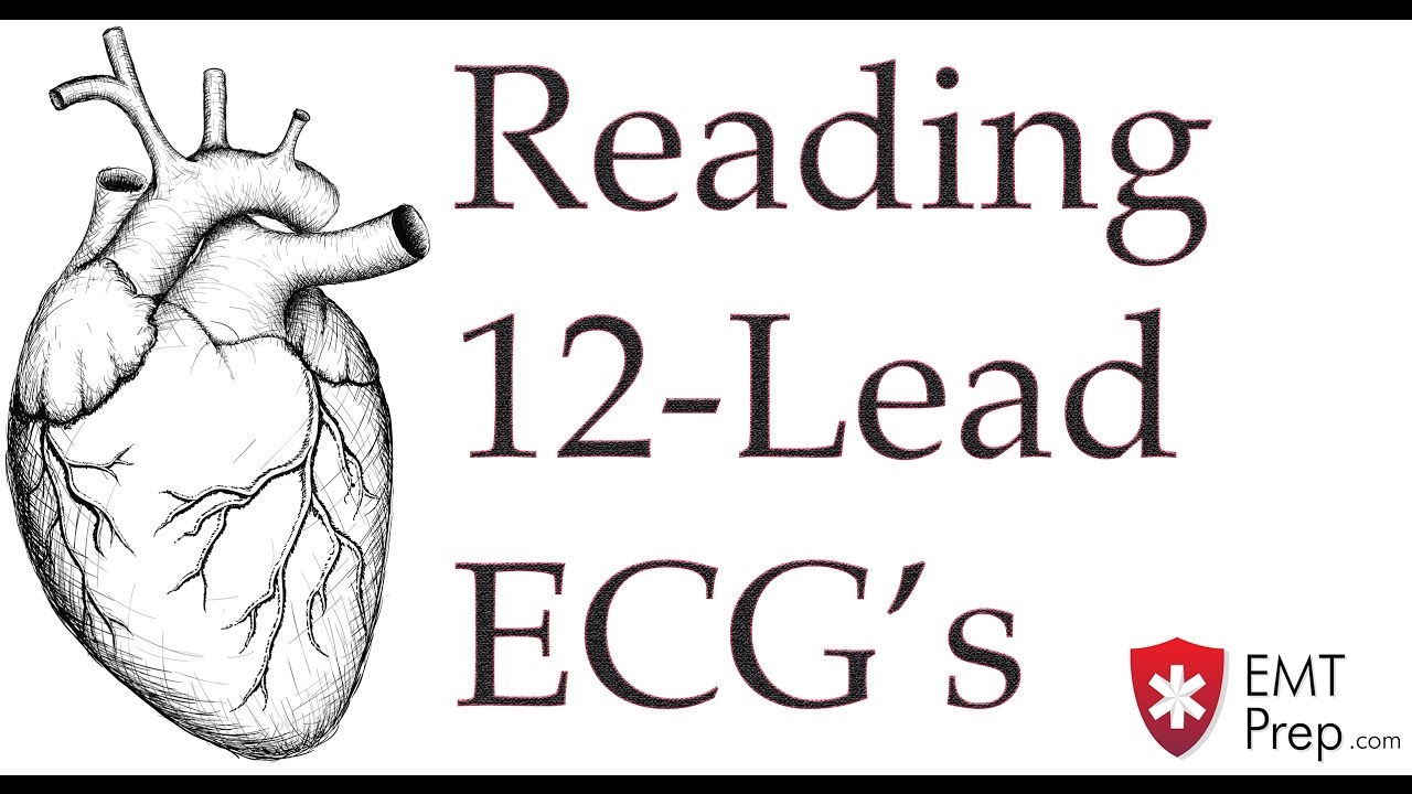 Reading 12-Lead ECG's - EMTprep.com - YouTube