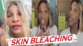 Light Skinned Serena Williams Says She is NOT Bleaching Her Skin