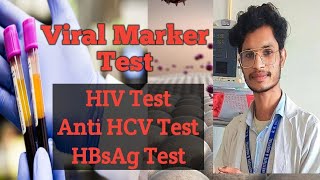 What is viral marker test? how to do viral marker test? HIV(AIDS)anti HCV,HBsAg Hepatitis B&C.