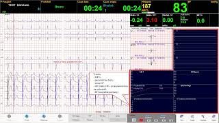 Oprogramowanie do próby wysiłkowej CardioScan StressTest - OXFORD POL