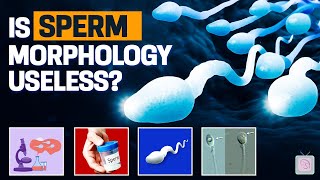 You shouldn't worry about sperm morphology for fertility